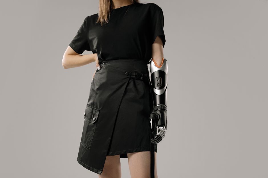 Mujer con atuendo negro y un brazo protésico elegante, mostrando moda y tecnología modernas.