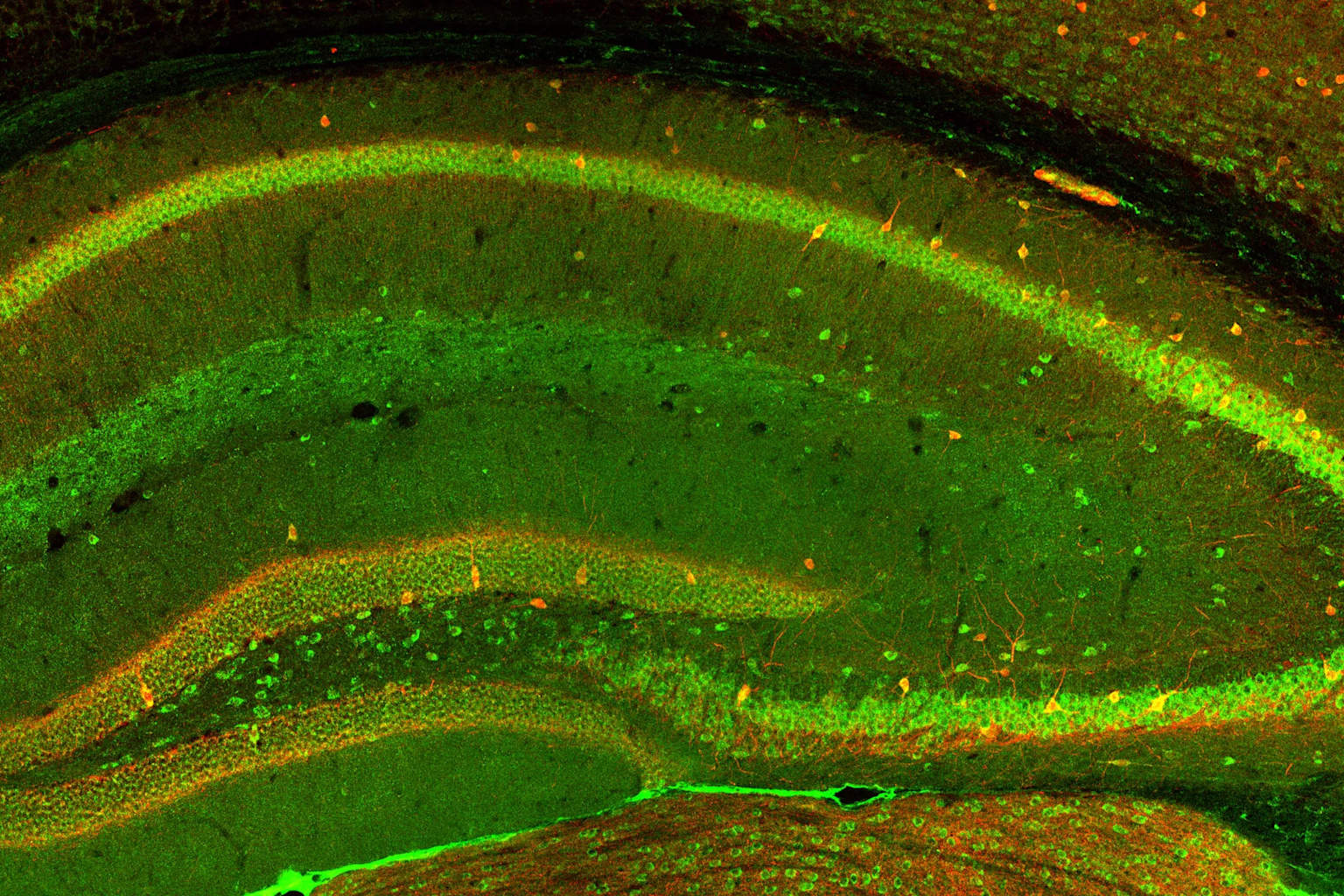 Ciencia revela por qué el dolor crónico causa depresión