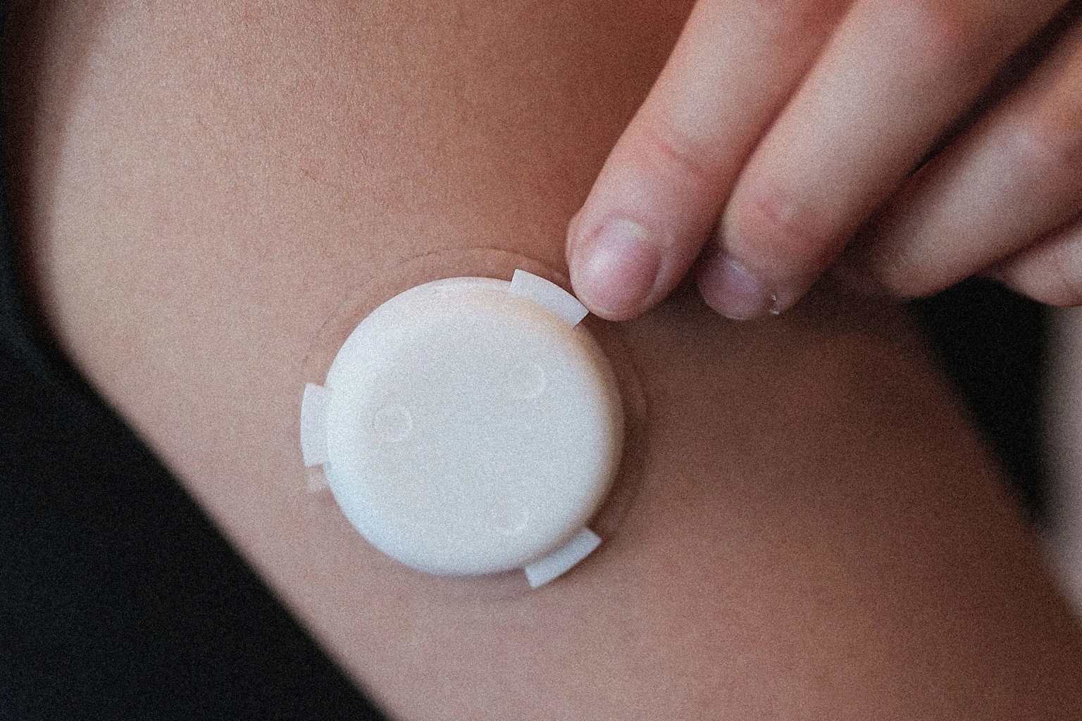 Crean parche wearable que evita análisis de sangre en FIV