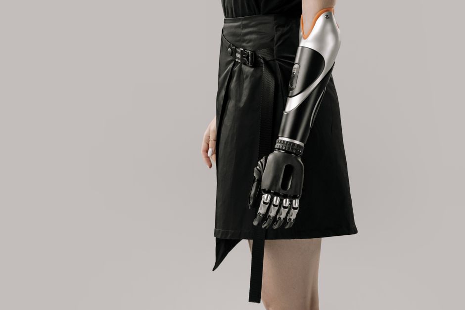 Primer plano de una mujer que lleva un brazo protésico moderno con una falda negra elegante, sobre un fondo gris.