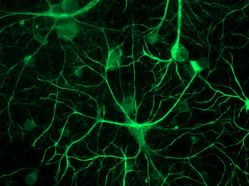 Descubren red secreta en el cerebro creada por astrocitos