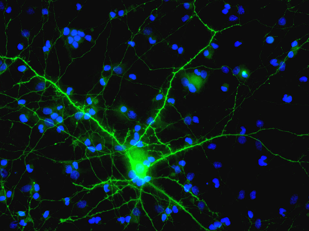 Entrenan neuronas vivas para tareas de machine learning