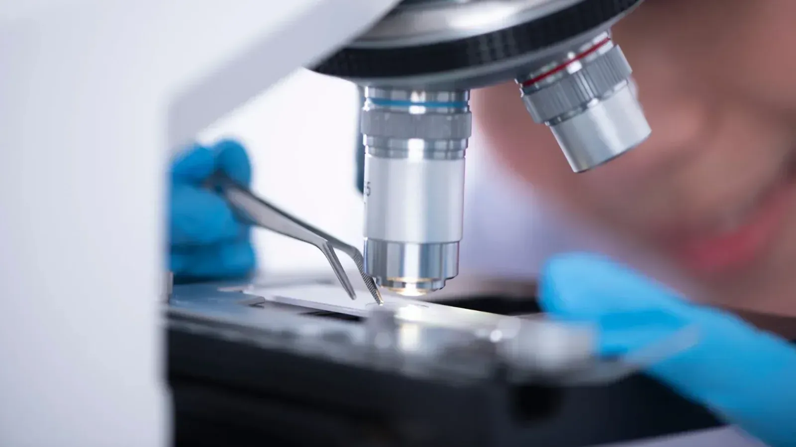 Estudio vincula cannabinoides con ansiedad en ratones