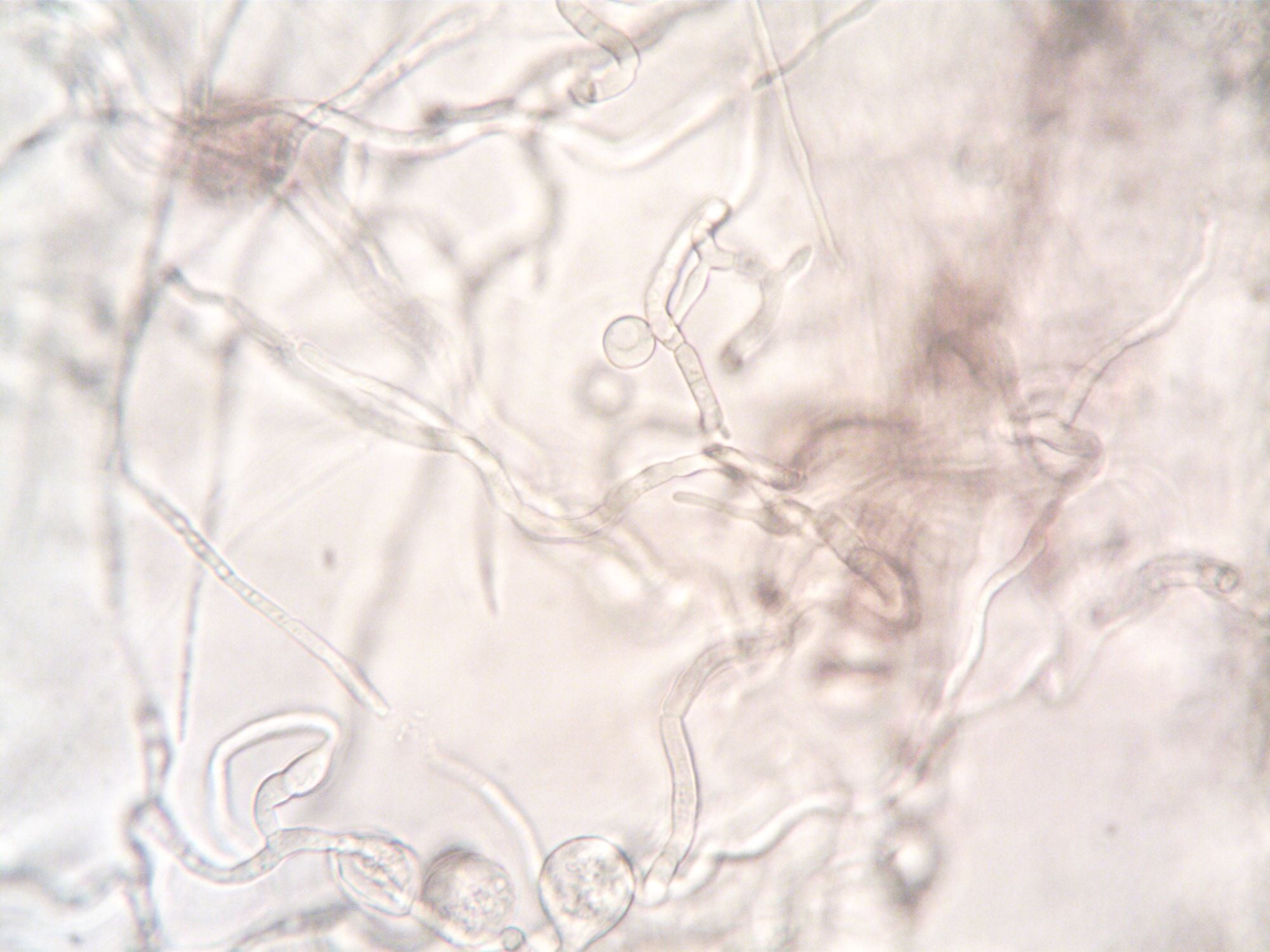 Genes: un patrón para activarlos, varios para silenciarlos