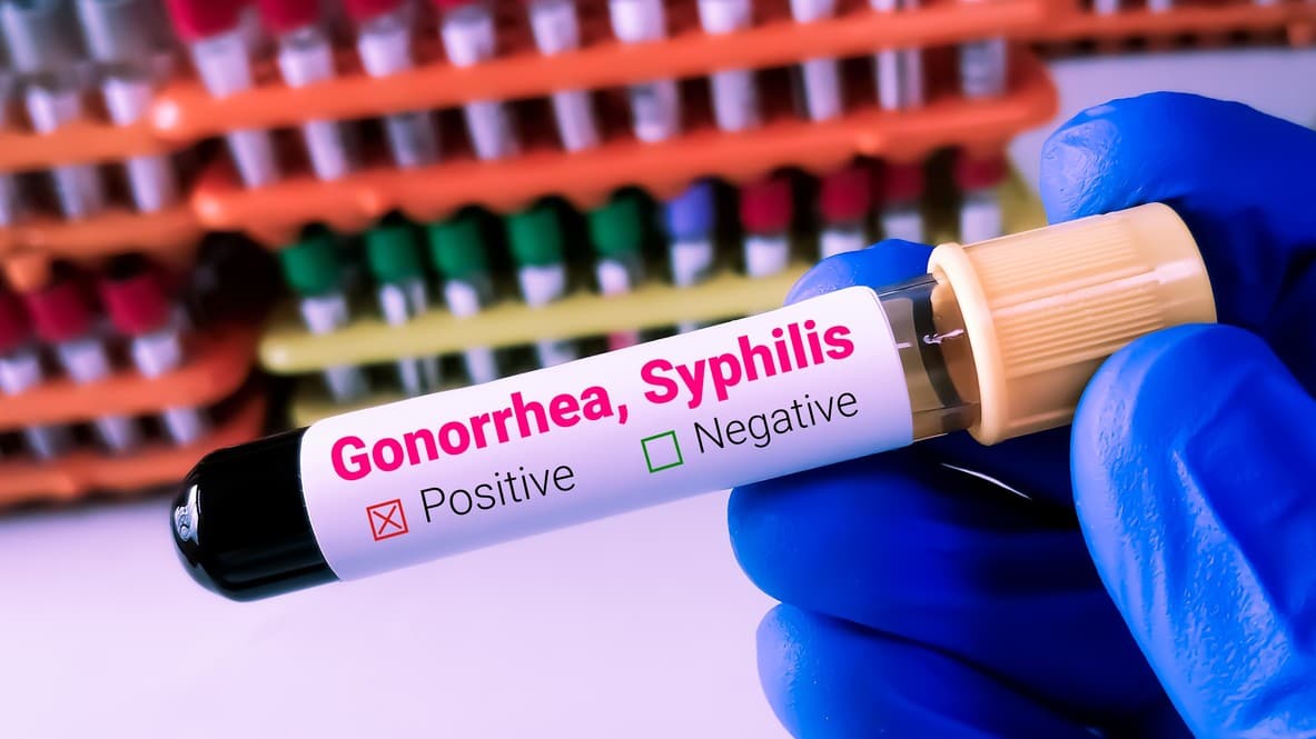 Gonorrea y sífilis registran máximos históricos en Europa