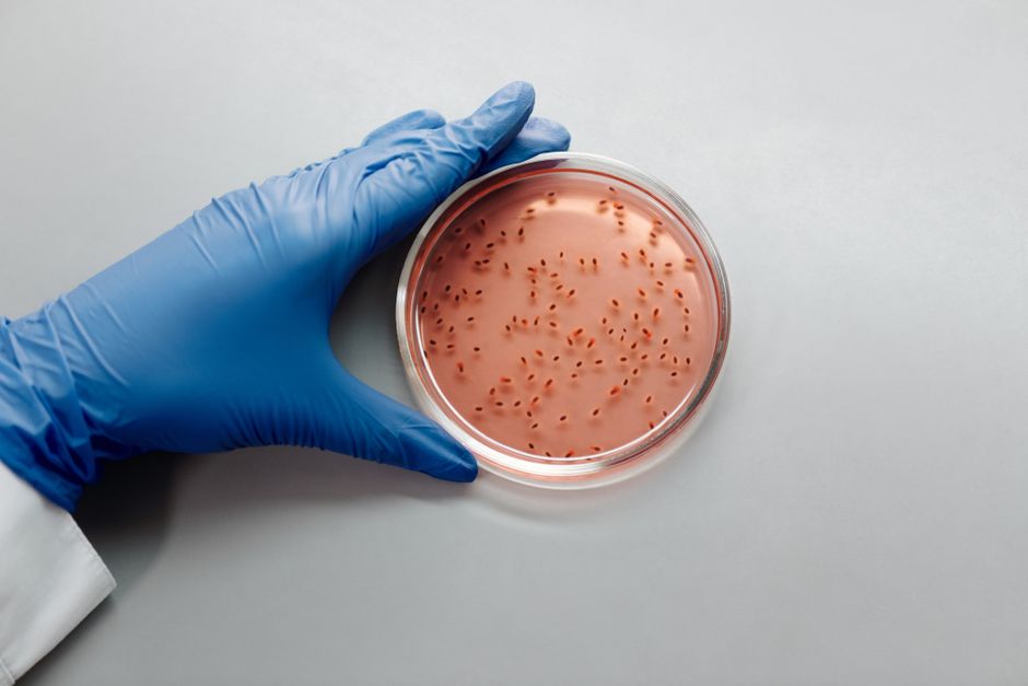 Un científico con guantes azules examina un cultivo bacteriano en una placa de Petri en un entorno de laboratorio.