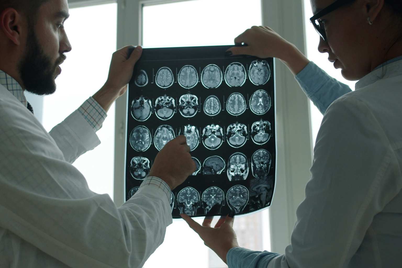 Identifican el trastorno cerebral recesivo más común