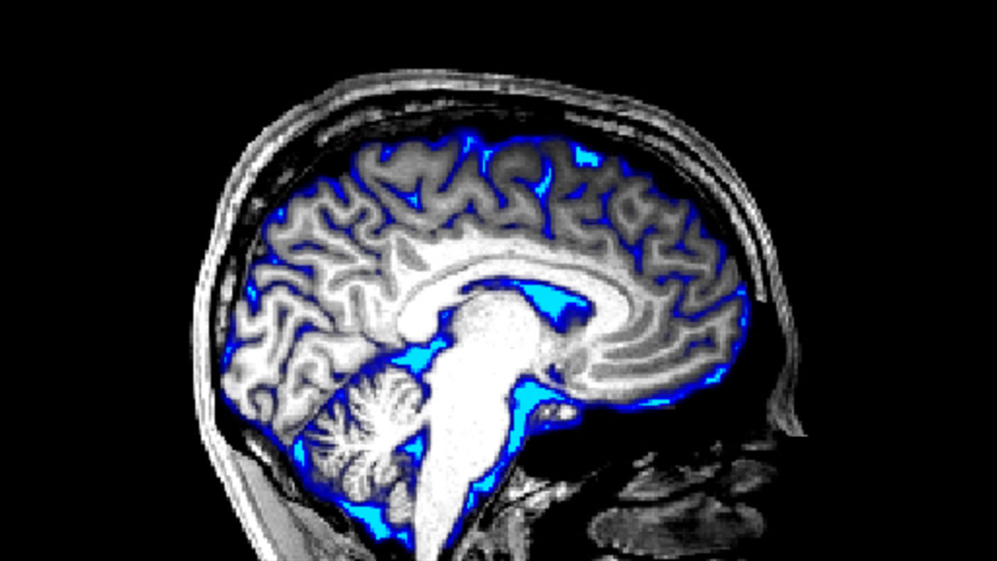 Inteligencia artificial mapea la limpieza del cerebro por primera vez