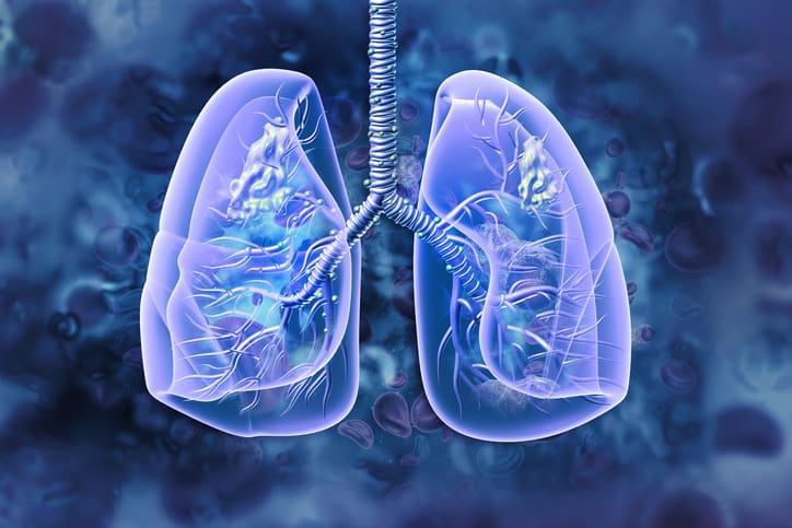 Ivonescimab baja 34% la mortalidad por cáncer de pulmón