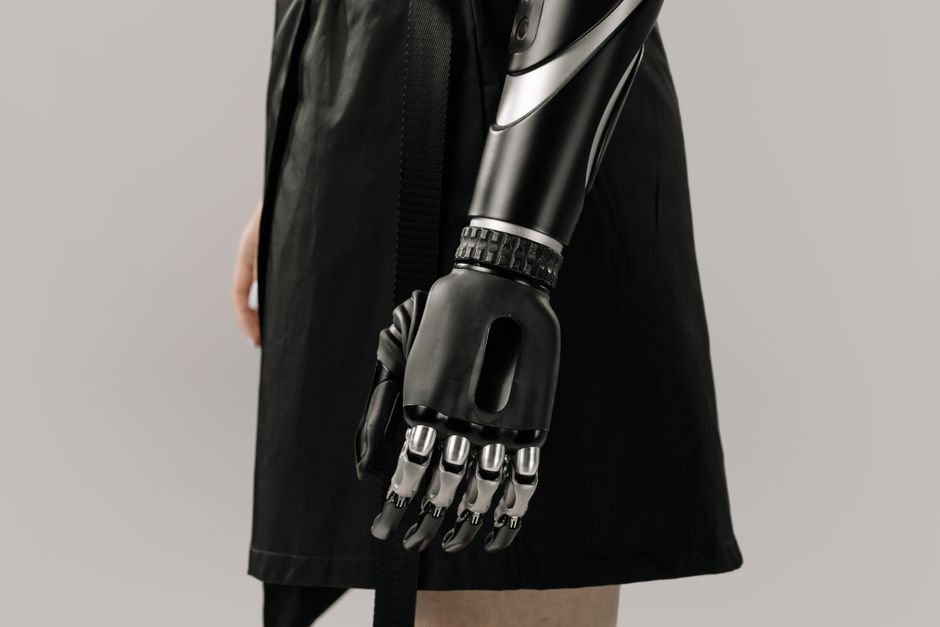 Una imagen contemporánea que muestra un elegante brazo protésico negro en una mujer, destacando la tecnología moderna.
