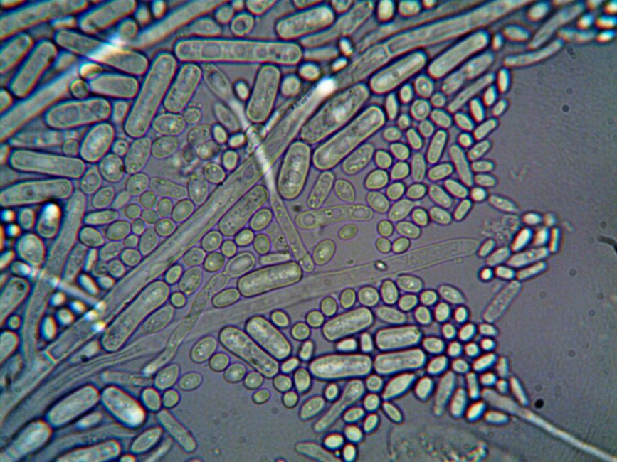 Imágenes microscópicas detalladas de microorganismos a alta magnificación.