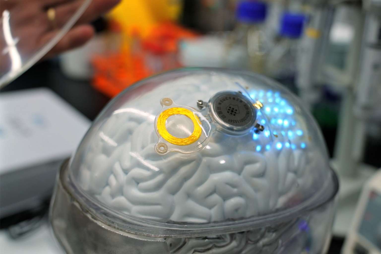 NeuCyber admite un rezago de 3 años frente a Neuralink