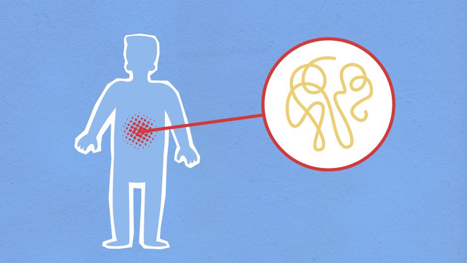 Ilustración creativa que representa una infección estomacal con enfoque en patógenos virales.