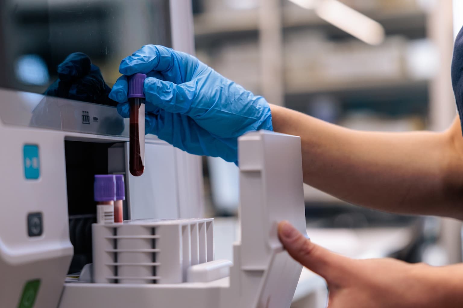 Prueba predice demencia hasta 25 años antes