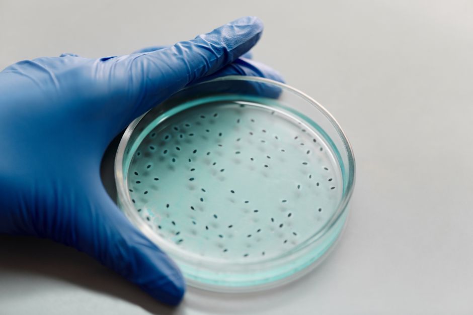 Mano enguantada sosteniendo una placa de Petri que contiene colonias bacterianas para investigación científica.