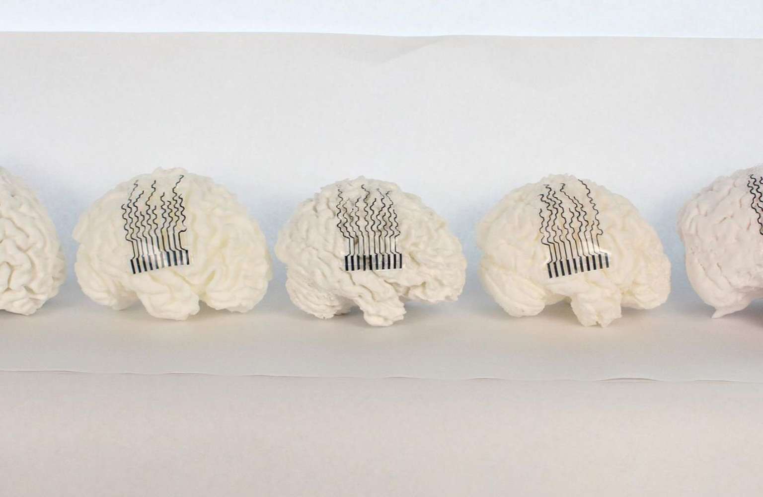 Sensores cerebrales en 3D a la medida del paciente