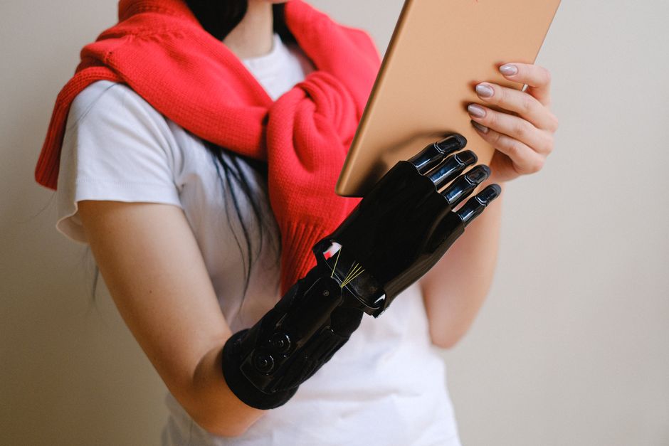 Una persona con una mano biónica sosteniendo una tableta, mostrando tecnología protésica avanzada.
