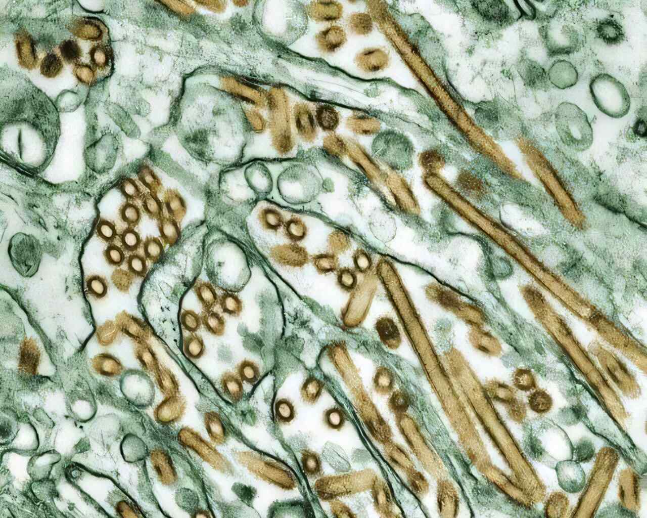 Vacuna de influenza reduce 73% mortalidad por H5N1