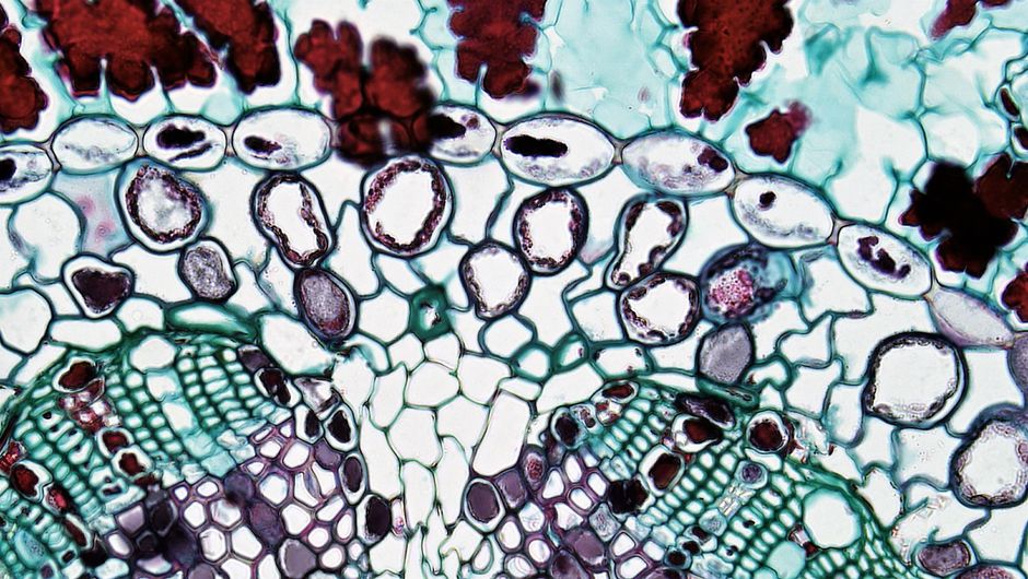 Imagen microscópica colorida que muestra los intrincados detalles de las células del tejido vegetal.