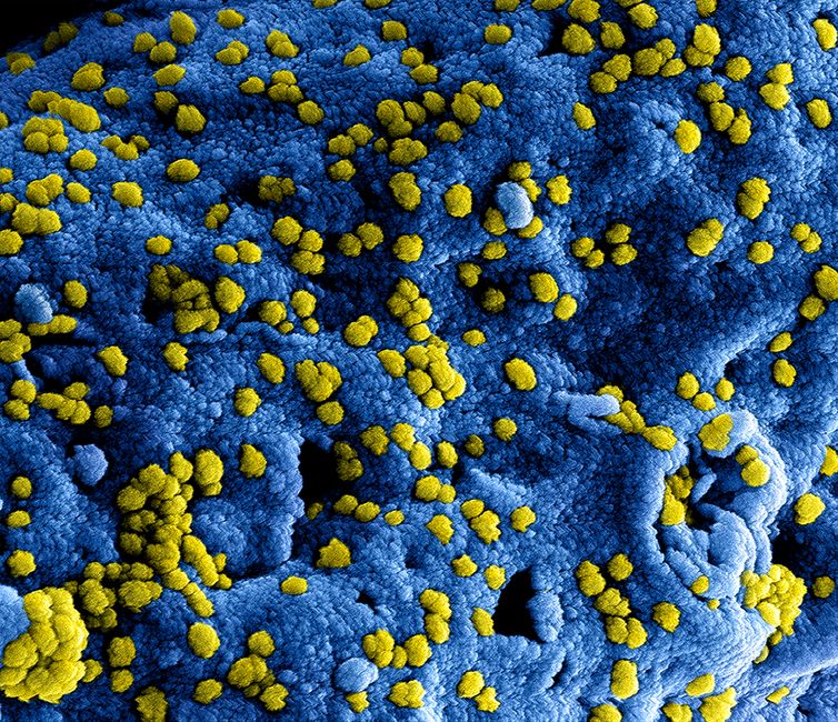 Vista microscópica de partículas de virus amarillas sobre una superficie azul, mostrando detalles intrincados.